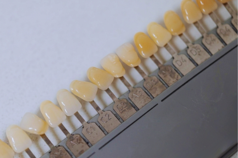 Guía de tonos dentales para estética dental con muestras de color alineadas sobre fondo blanco.